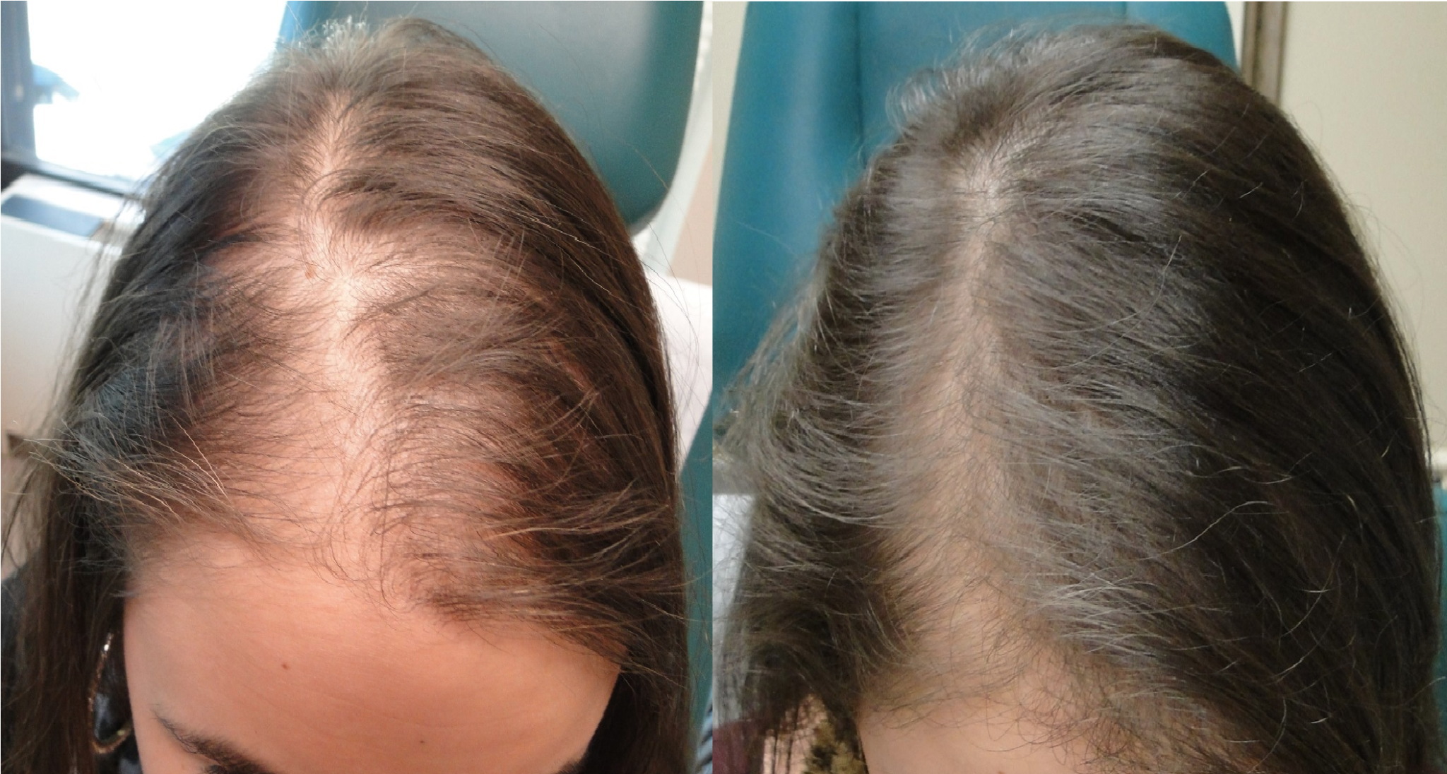 Goals Healthcare - Best NYC Hair Loss Treatment - Dr. Shanna Levine MD